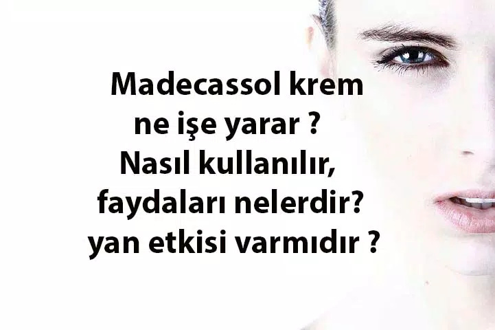 Madecassol krem ne işe yarar ? Kullanımı, yan etkisi