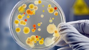 Piyeloseptyl ne ise yarar