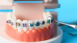 ortodonti ne demek 