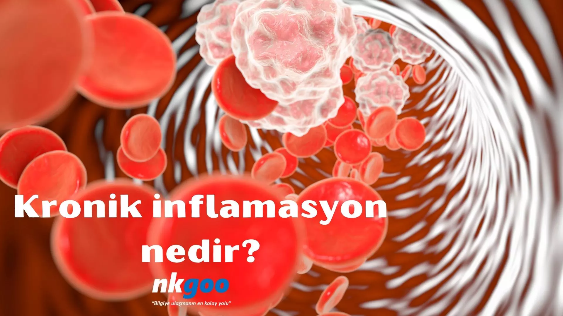 Kronik inflamasyon nedir? Belirtileri, tedavisi