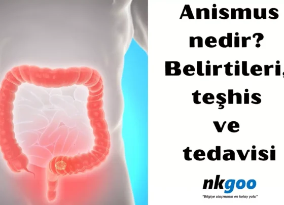 Anismus nedir