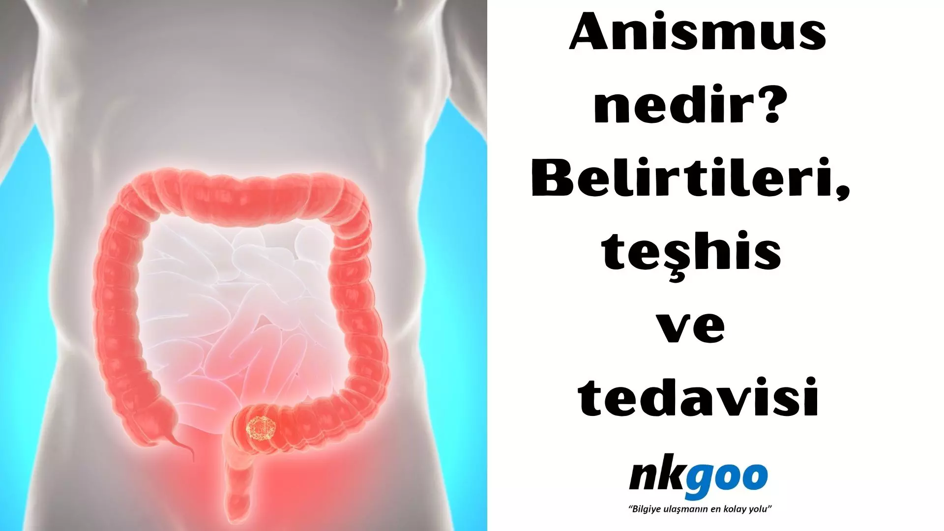 Anismus nedir? Belirtileri, teşhis ve tedavisi