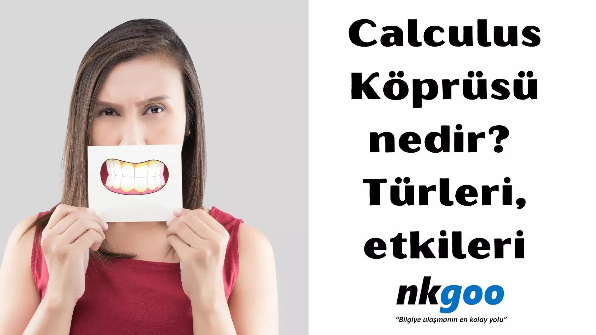 Calculus Köprüsü nedir? Türleri, etkileri, Önleme