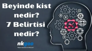 Beyinde kist nedir 