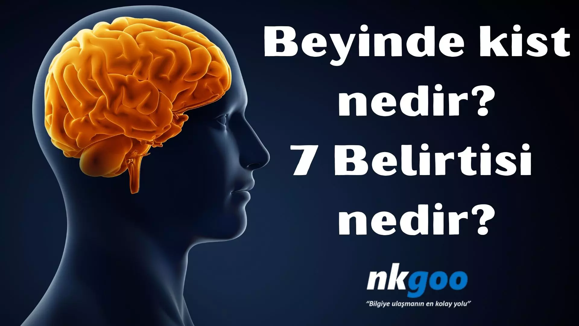 Beyinde kist nedir belirtileri nelerdir? 7 belirtisi