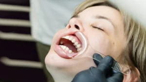 Periodontoloji Nedir 