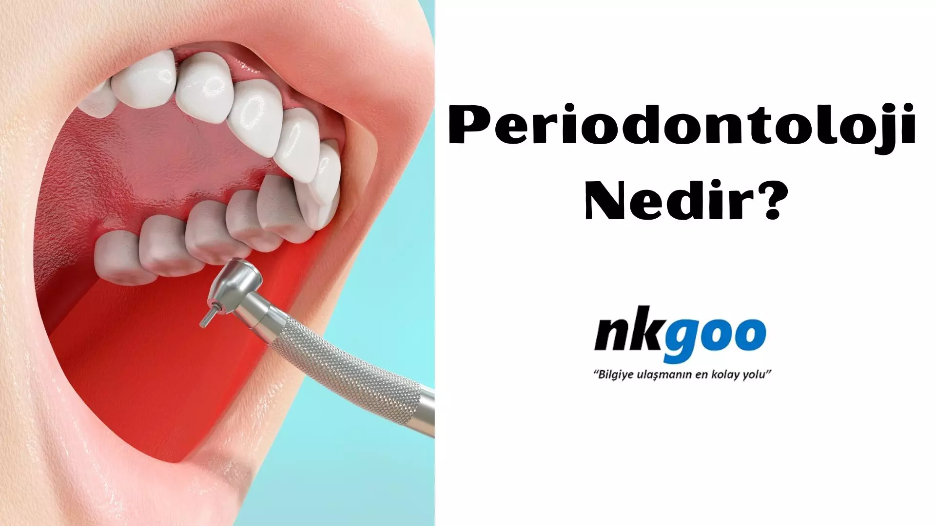 Periodontoloji Nedir? Neye bakar? Tedavisi