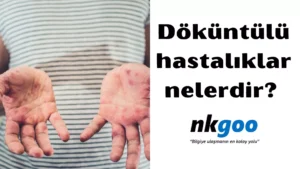 Döküntülü hastalıklar 