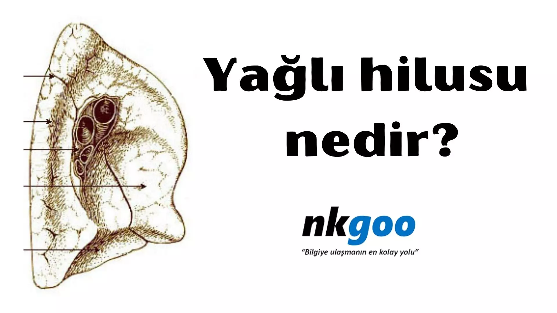 Yağlı hilusu nedir? 8 sebebi nelerdir?