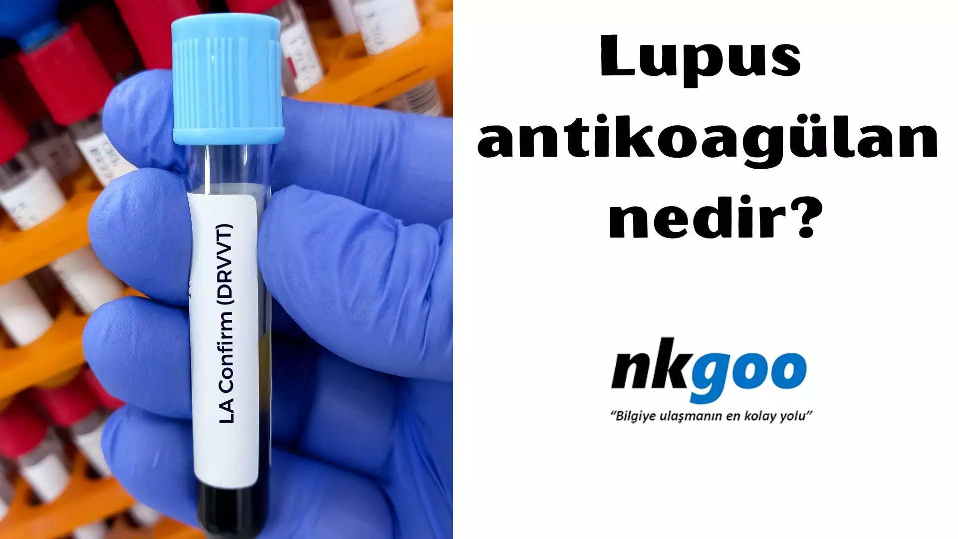 Lupus antikoagülan nedir? 5 tanı şekli