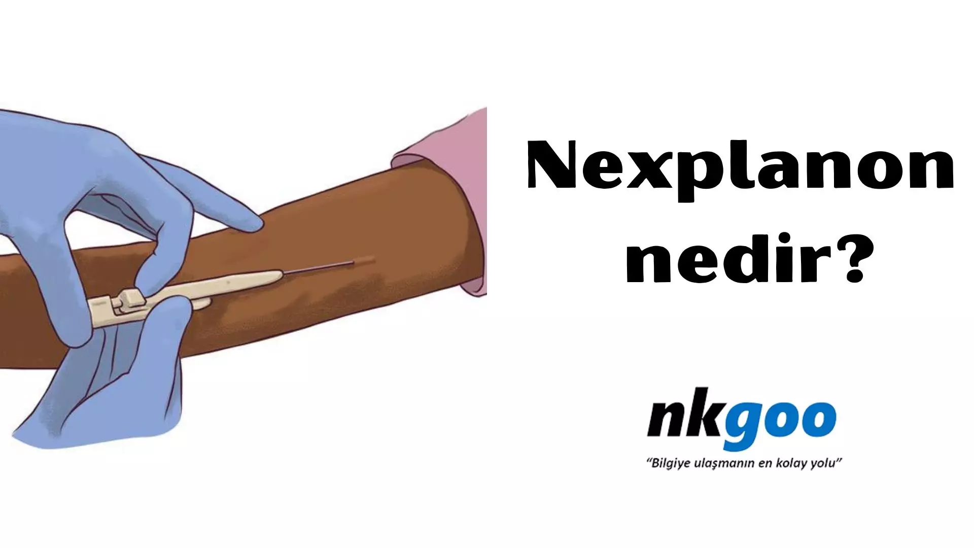 Nexplanon nedir? 5 önemli nokta