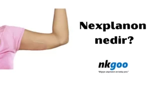 Nexplanon nedir