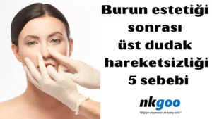 burun estetiği sonrası üst dudak hareketsizliği 