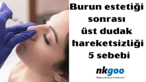 burun estetiği sonrası üst dudak hareketsizliği 