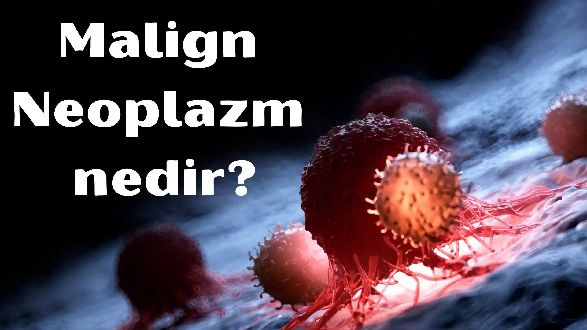 Malign Neoplazm nedir? 8 Nedeni