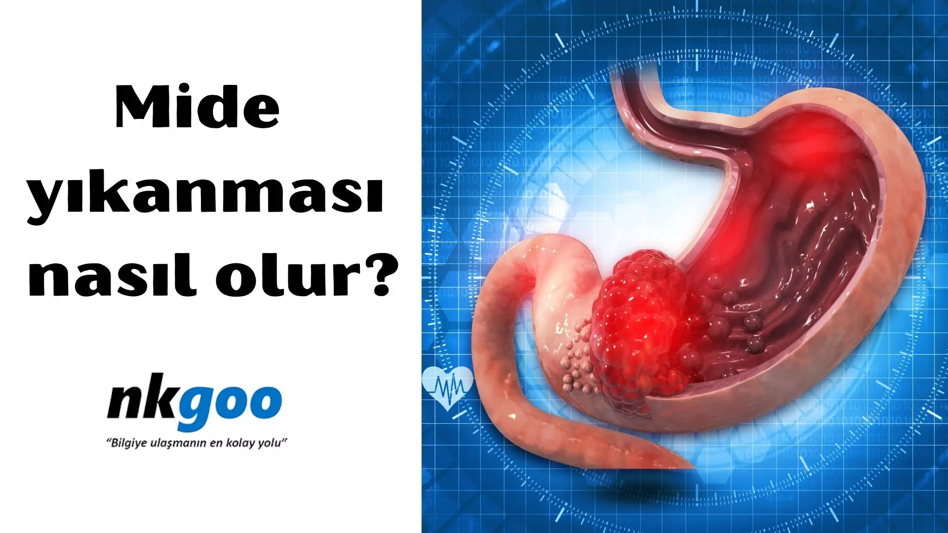 Mide yıkanması nasıl olur? 7 Adımı nedir?